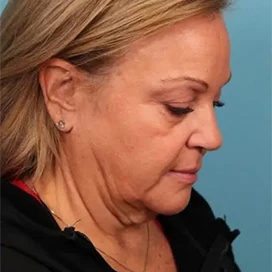Before treatment patient result